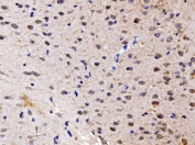 IHC staining of FFPE mouse brain tissue with FKBP15 antibody. HIER: boil tissue sections in pH8 EDTA for 20 min and allow to cool before testing.