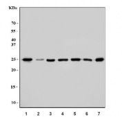Western blot testing of 1) human HeLa, 2) human 293T, 3) human HepG2, 4) rat liver, 5) rat kidney, 6) mouse liver and 7) mouse kidney tissue lysate with TPI1 antibody. Predicted molecular weight ~26 kDa.