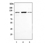 Western blot testing of human 1) 293T, 2) HCCT and 3) HepG2 cell lysate with IRE2 antibody. Predicted molecular weight ~102 kDa.