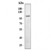 Western blot testing of human RT-4 cell lysate with NLRP7 antibody. Predicted molecular weight ~112 kDa.