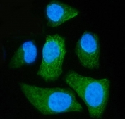 Immunofluorescent staining of FFPE human HeLa cells with MCART1/2 antibody (green) and DAPI nuclear stain (blue). HIER: steam section in pH6 citrate buffer for 20 min.