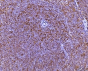 IHC staining of FFPE mouse spleen tissue with Mip-1 alpha antibody. HIER: boil tissue sections in pH8 EDTA for 20 min and allow to cool before testing.