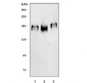 Western blot testing of 1) human HeLa, 2) human MCF7 and 3) mouse NIH 3T3 cell lysate with ERBB2 antibody. Expected molecular weight: 139-185 kDa depending on glycosylation level.