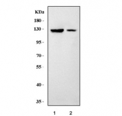 Western blot testing of 1) rat brain and 2) mouse brain tissue lysate with ERG-1 antibody. Expected molecular weight: 127-155 kDa.