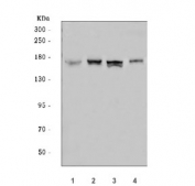 Western blot testing of human 1) 293T, 2) Raji, 3) PC-3 and 4) U-251 cell lysate with SLIT2 antibody. Expected molecular weight: ~180-210 kDa (full length), ~140 kDa (N-terminal fragment), 55-60 kDa (C-terminal fragment).