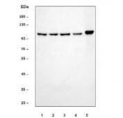 Western blot testing of human 1) HeLa, 2) 293T, 3) HepG2, 4) Jurkat and 5) Raji cell lysate with STAT6 antibody. Predicted molecular weight ~94 kDa.