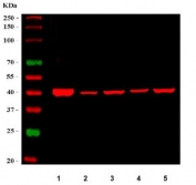 Western blot testing of 1) human HCCP, 2) rat kidney, 3) rat liver, 4) mouse kidney and 5) mouse liver tissue lysate with WNT7A antibody. Expected molecular weight ~39 kDa.