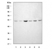 Western blot testing of human 1) Jurkat, 2) Raji, 3) K562, 4) RT4, 5) HEL and 6) HeLa cell lysate with TRIT1 antibody. Predicted molecular weight ~53 kDa.