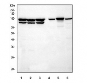 Western blot testing of 1) human Jurkat, 2) human A549, 3) human MCF7, 4) rat brain, 5) mouse spleen and 6) mouse brain tissue cell lysate with FOXP1 antibody at 1:500 dilution. Expected molecular weight: 65-77 kDa (multiple isoforms).