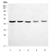 Western blot testing of 1) human HepG2, 2) human MOLT-4, 3) human MCF7, 4) rat heart and 5) mouse heart tissue lysate with TRMT2B antibody. Predicted molecular weight: 51-56 kDa (multiple isoforms).