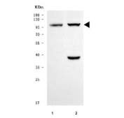 Western blot testing of 1) rat heart and 2) mouse heart tissue lysate with TNNI3K antibody. Predicted molecular weight: 78-104 kDa (multiple isoforms).