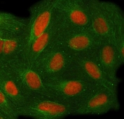 Immunofluorescent staining of FFPE human U-2 OS cells with Target of EGR1 protein 1 antibody (red) and Alpha Tubulin mAb (green). HIER: steam section in pH6 citrate buffer for 20 min.