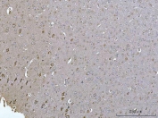 IHC staining of FFPE rat brain tissue with SELT antibody. HIER: boil tissue sections in pH8 EDTA for 20 min and allow to cool before testing.
