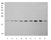 Western blot testing of 1) human A431, 2) human U-251, 3) human Caco-2, 4) human MCF7, 5) human T-47D, 6) human RT4, 7) rat pancreas, 8) mouse pancreas and 9) mouse NIH 3T3 cell lysate with SELT antibody. Predicted molecular weight ~22 kDa.