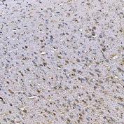IHC staining of FFPE rat brain tissue with TOM1L1 antibody. HIER: boil tissue sections in pH8 EDTA for 20 min and allow to cool before testing.