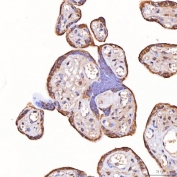 IHC staining of FFPE human placental tissue with TOMM34 antibody. HIER: boil tissue sections in pH8 EDTA for 20 min and allow to cool before testing.