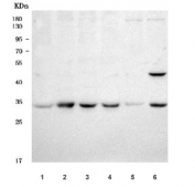 Western blot testing of 1) human A549, 2) human A375, 3) human HeLa, 4) human 293T, 5) rat testis and 6) mouse testis tissue lysate with TOMM34 antibody. Predicted molecular weight ~34 kDa.
