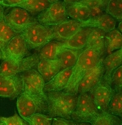 Immunofluorescent staining of FFPE human MCF7 cells with RRP1B antibody (red) and Beta Tubulin mAb (green). HIER: steam section in pH6 citrate buffer for 20 min.