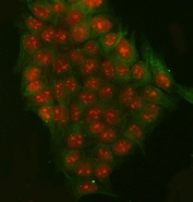 Immunofluorescent staining of FFPE human MCF7 cells with RRP7A antibody (red) and Beta Tubulin mAb (green). HIER: steam section in pH6 citrate buffer for 20 min.