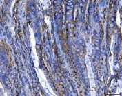 IHC staining of FFPE rat colon tissue with TRIM16 antibody. HIER: boil tissue sections in pH8 EDTA for 20 min and allow to cool before testing.