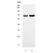 Western blot testing of human 1) RT4 and 2) HeLa cell lysate with TRIM16 antibody. Predicted molecular weight: 54-63 kDa (multiple isoforms).