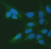 Immunofluorescent staining of FFPE human U-2 OS cells with SETD3 antibody (green) and DAPI nuclear stain (blue). HIER: steam section in pH6 citrate buffer for 20 min.