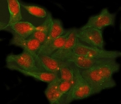 Immunofluorescent staining of FFPE human HeLa cells with TSHZ1 antibody (red) and Alpha Tubulin mAb (green). HIER: steam section in pH8 EDTA buffer for 20 min.