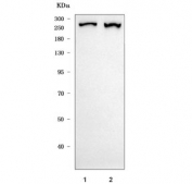 Western blot testing of human 1) HeLa and 2) 293T cell lysate with TPRBK antibody. Predicted molecular weight ~271 kDa.
