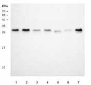 Western blot testing of 1) human HeLa, 2) human 293T, 3) human A549, 4) human MCF7, 5) rat brain, 6) mouse kidney and 7) mouse brain tissue with TSR2 antibody. Predicted molecular weight ~23 kDa, commonly observed at 23-30 kDa.