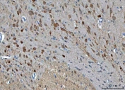 IHC staining of FFPE rat brain tissue with TSR2 antibody. HIER: boil tissue sections in pH8 EDTA for 20 min and allow to cool before testing.
