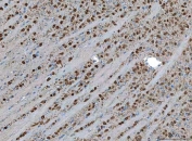 IHC staining of FFPE mouse brain tissue with TSR2 antibody. HIER: boil tissue sections in pH8 EDTA for 20 min and allow to cool before testing.