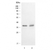 Western blot testing of human 1) A431 and 2) HaCaT cell lysate with SDCBP2 antibody. Predicted molecular weight ~32 kDa, commonly observed at 32-37 kDa with a possible ~23 kDa isoform.
