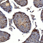 IHC staining of FFPE mouse testis tissue with TTLL2 antibody. HIER: boil tissue sections in pH8 EDTA for 20 min and allow to cool before testing.