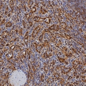 IHC staining of FFPE human spleen tissue with Selenium Binding Protein antibody. HIER: boil tissue sections in pH8 EDTA for 20 min and allow to cool before testing.