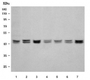 Western blot testing of 1) human HeLa, 2) human 293T, 3) human K562, 4) human HepG2, 5) monkey COS7, 6) human Jurkat and 7) rat C6 cell lysate with SMARCB1 antibody. Predicted molecular weight: 43-44 kDa (two isoforms).