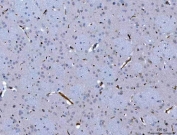 IHC staining of FFPE rat brain tissue with Semaphorin-4F antibody. HIER: boil tissue sections in pH8 EDTA for 20 min and allow to cool before testing.
