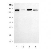Western blot testing of human 1) HeLa, 2) K562, 3) HepG2 and 4) A549 cell lysate with DSG2 antibody. Expected molecular weight: 122-160 kDa depending on glycosylation level.