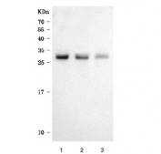 Western blot testing of human 1) MOLT-4, 2) SH-SY5Y and 3) Jurkat cell lysate with FAM60A antibody. Predicted molecular weight ~25 kDa.