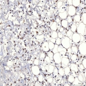 IHC staining of FFPE rat skin tissue with TRMT61A antibody. HIER: boil tissue sections in pH8 EDTA for 20 min and allow to cool before testing.