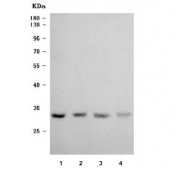 Western blot testing of human 1) PC-3, 2) Caco-2, 3) MCF7 and 4) HaCaT cell lysate with TRMT61A antibody. Predicted molecular weight ~31 kDa.