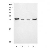 Western blot testing of 1) human HepG2, 2) human 293T, 3) rat liver and 4) rat kidney tissue lysate with SLC25A10 antibody. Predicted molecular weight ~31 kDa.