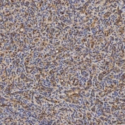 IHC staining of FFPE human spleen tissue with SLC25A24 antibody. HIER: boil tissue sections in pH8 EDTA for 20 min and allow to cool before testing.