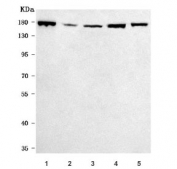 Western blot testing of 1) human HeLa, 2) human K562, 3) human U-87 MG, 4) rat PC-12 and 5) mouse lung tissue lysate with Rho kinase 2 antibody. Predicted molecular weight ~161 kDa.