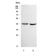 Western blot testing of human 1) A431 and 2) SiHa cell lysate with SLC35E4 antibody. Predicted molecular weight ~37 kDa.