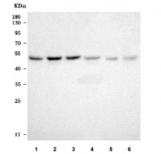 Western blot testing of 1) human 293T, 2) human HeLa, 3) human A549, 4) human HepG2, 5) rat stomach and 6) mouse ovary tissue lysate with TXNDC5 antibody. Predicted molecular weight ~48 kDa.