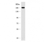 Western blot testing of human HEK293 cell lysate with Integrin alpha 8 antibody. Predicted molecular weight ~117 kDa but may be observed at higher molecular weights due to glycosylation.
