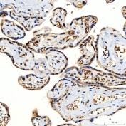 IHC staining of FFPE human placental tissue with SNF2H antibody. HIER: boil tissue sections in pH8 EDTA for 20 min and allow to cool before testing.