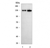 Western blot testing of human 1) HepG2 and 2) HeLa cell lysate with SNF2H antibody. Predicted molecular weight ~122 kDa.