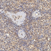 IHC staining of FFPE human spleen tissue with SNF2H antibody. HIER: boil tissue sections in pH8 EDTA for 20 min and allow to cool before testing.