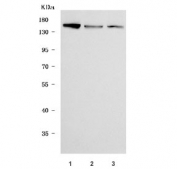 Western blot testing of human 1) 293T, 2) HeLa and 3) HepG2 cell lysate with SMC1A antibody. Predicted molecular weight ~143 kDa. 